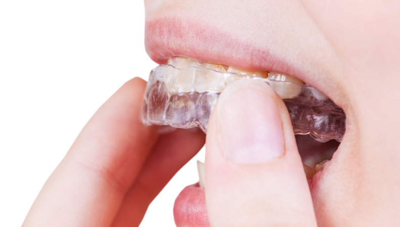 tipos de ortodoncia